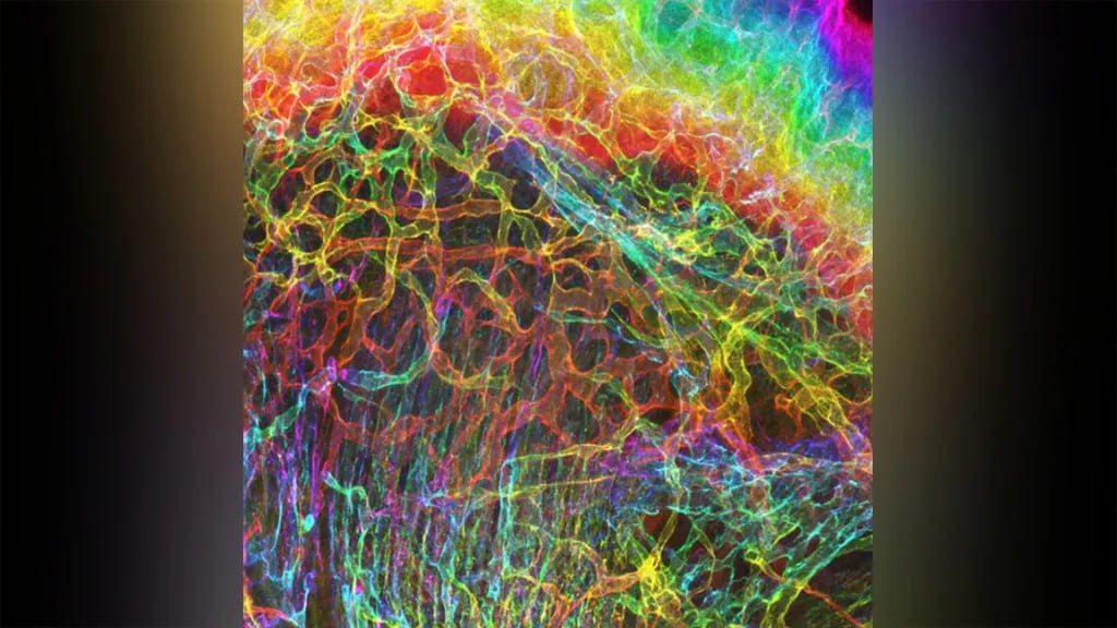 Skin-Muscle-Interface-large-1024x576